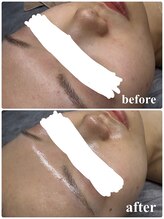 ビズエー(viz.A)/ワックス＋ハーブ