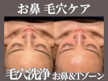 マヴィ 今福鶴見店(MavY.)/毛穴お悩みの方に！