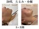 ランティル(l’until)の写真