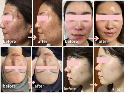 マヨズサロン(MAYO's salon)の写真
