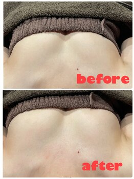 グロー(GLOW)/バストアップケア