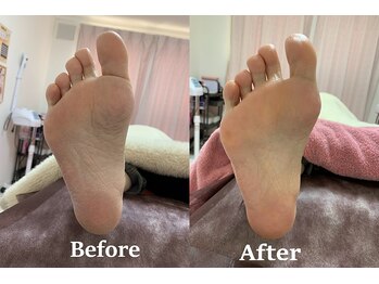 脱毛 フェイシャルサロン 光/フットトリートメント