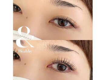 シュエット(Chouette)/アンドヘルシー100本