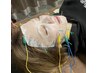 初回限定！プラセンタ×電気美容鍼で最高のリフトアップを♪￥11000→8980