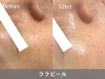 RHB東戸塚/小顔エステはRHB東戸塚