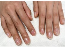 地爪ケアクリニックサロン 松江/自信が持てる綺麗な美爪へ