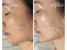 AK エステティックス(AK Esthetics)/シュっとした輪郭に★小顔ケア