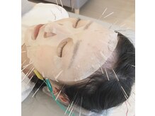 経堂鍼灸整体院