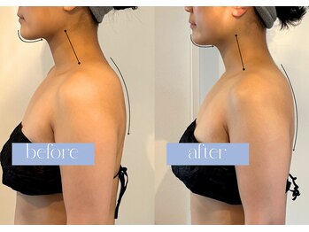 ステラ(STELLA)/猫背・姿勢改善が気になる方に◎