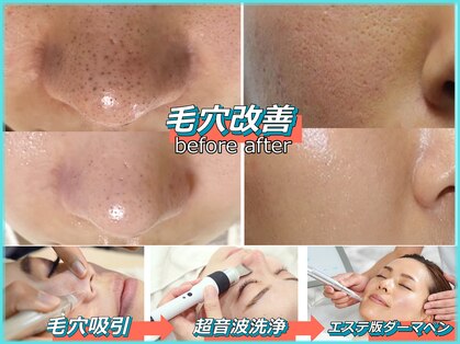 パルテールの写真