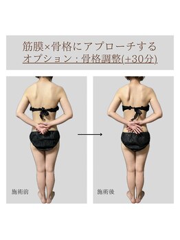 ソルヴィス 根本(soLvis)/オーダーメイドの筋膜リリース