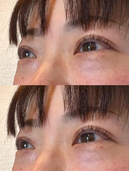 ヘアーウニール アイ(Hair Unir eye)/【40代後半】引き上げパリ
