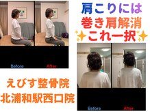 えびす整骨院 北浦和駅西口院/肩こりは巻き肩解消！これ一択♪