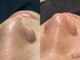 アイルーム 大宮店(eyeroom)の写真/【大宮駅徒歩9分/23時迄営業】仕事帰りに通いやすい好立地♪美眉と美肌を叶えるアイブロウ専門サロン♪