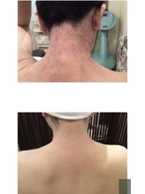 素肌新館 沼津店/ボディー