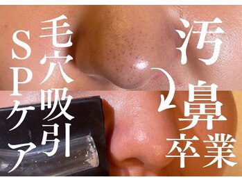 ステラグランデ(Stella grande)の写真/★汚鼻卒業★SP毛穴吸引〈ひきしめケア付〉60分 初回限定3,980円(クーポン)