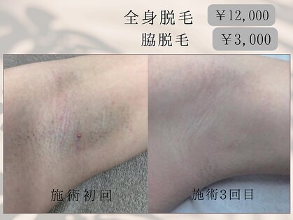 サロン ド ジュエル(salon de jewel)の写真