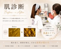 肌質改善サロン 姫路駅前店