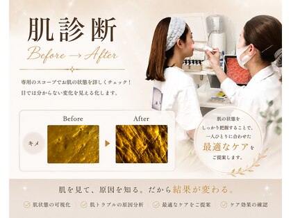 肌質改善サロン 姫路駅前店の写真
