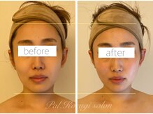 パル コルギサロン(Pal. Korugi salon)/コルギビフォーアフター