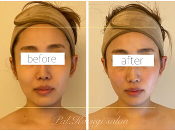 パル コルギサロン(Pal. Korugi salon)/コルギビフォーアフター