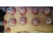 ティアラボ(TIARABO)/カッピング