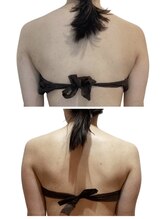 痩せラボ/背中を軽やかに【痩身】