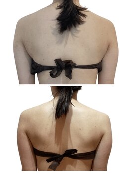 痩せラボ/背中を軽やかに【痩身】