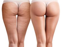 ヨサパーク グランス(YOSA PARK glans)/セル脂肪はルルオンにお任せ！