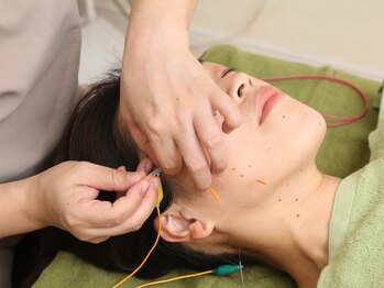 ラ フェリーチェ鍼灸院(La felice鍼灸院)/美容鍼施術