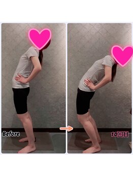 プルーム 大橋店(plume)/40代女性/首・肩こり、骨盤