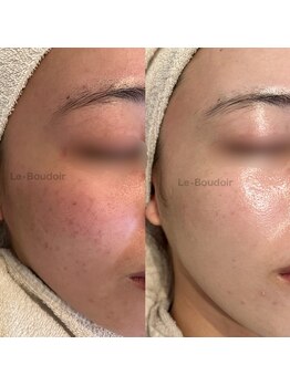 ルブドワール(Le Boudoir)/エンビロントリートメント