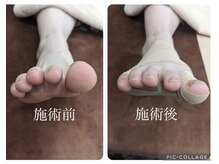 グランツ トリムリターン神奈川横浜店(glanz)の雰囲気（足トラブル対応年間1600件実績有◎#足痛#足指変形#O脚#膝痛#骨盤）