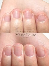 マリーロール 天王寺店(Marie Laure)/深爪矯正/自爪育成/ネイルケア　