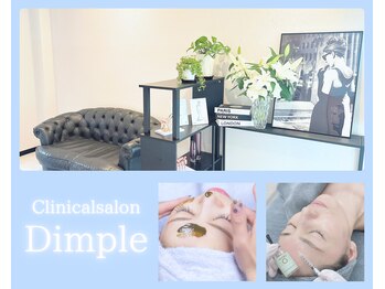 ディンプル(Dimple)