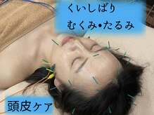 ビースタイル(B-style)の雰囲気（ヘッド＆フェイス＆デコルテを綺麗に。むくみ、くいしばりケア。）