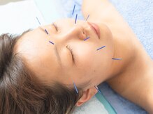 てんびん/お顔の悩みに美容鍼☆