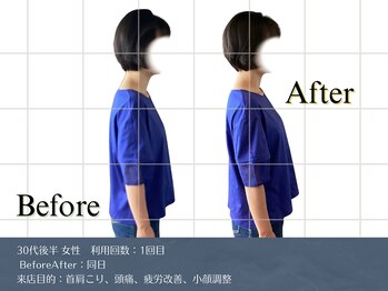 リビット 等々力(Rebit)/BeforeAfter,首肩こり,頭痛