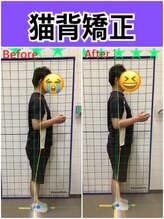 しんりふ接骨院/猫背矯正