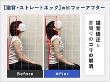 堺 中百舌鳥駅前整体院/ストレートネックの方に♪