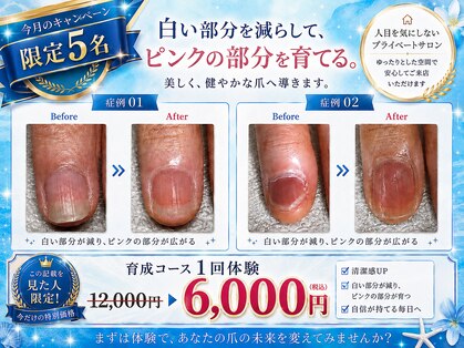 メイル(MEILU)の写真