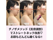 ピオニービューティー(Peony Beauty)/チノザメソッド【美骨痩身】