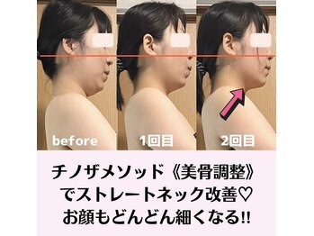 ピオニービューティー(Peony Beauty)/チノザメソッド【美骨痩身】