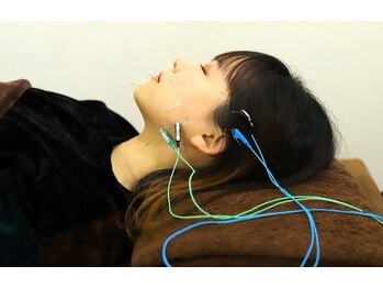 オリーブ鍼灸整骨院の写真/鍼灸で小顔とコリの同時改善！美しいフェイスラインと肩こり・腰痛の解消を手に入れよう♪