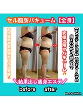 ビューティ ウィッチ(Beauty Witch)/セル脂肪徹底的分解！！