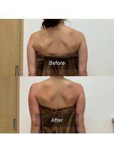 ルセヴィア(LUCEVIA)/痩身エステ（半身/上半身）