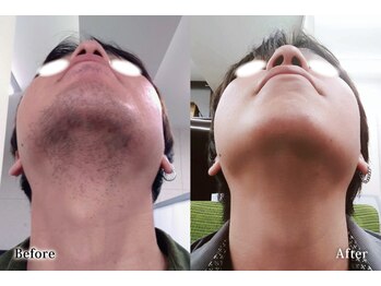 アネル 豊見城(anel)/