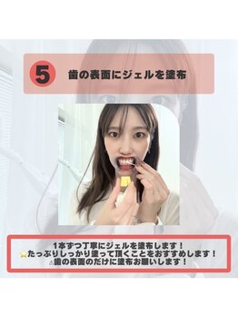 ホワイトニングショップ 福岡香椎店/セルフホワイトニングのやり方