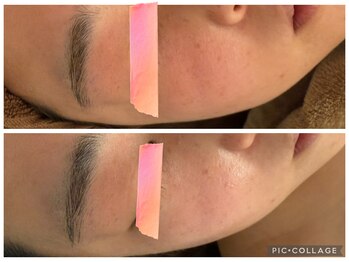 イディアル(IDE'AL)/塗るボトレベル＊陶肌ピール