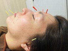 ケンビ(Kenbi)の雰囲気（特徴★電気を流さない☆少ない本数で引き上げる★肌に優しい施術）